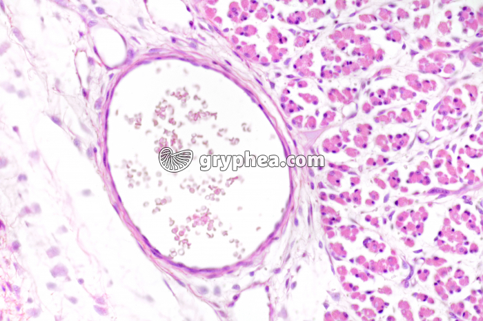 Veinule CT x100 - gryphea.com